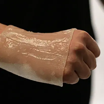 BurnFree: Apósitos anti quemaduras