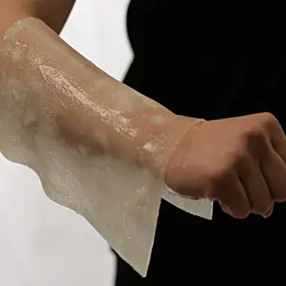 BurnFree: Apósitos anti quemaduras