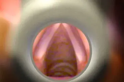 2. Llévelo bajo la epiglotis