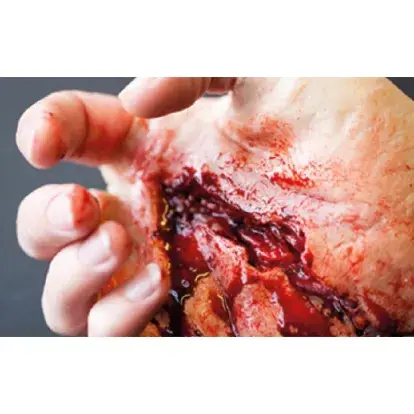 Kit de simulación de heridas y quemaduras